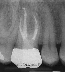 Molar